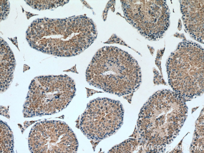 ROPN1L Antibody in Immunohistochemistry (Paraffin) (IHC (P))