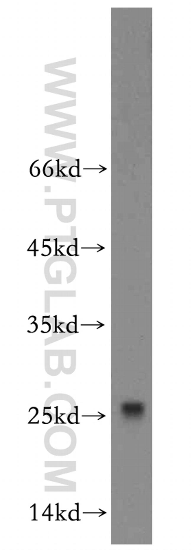 ROPN1L Antibody in Western Blot (WB)