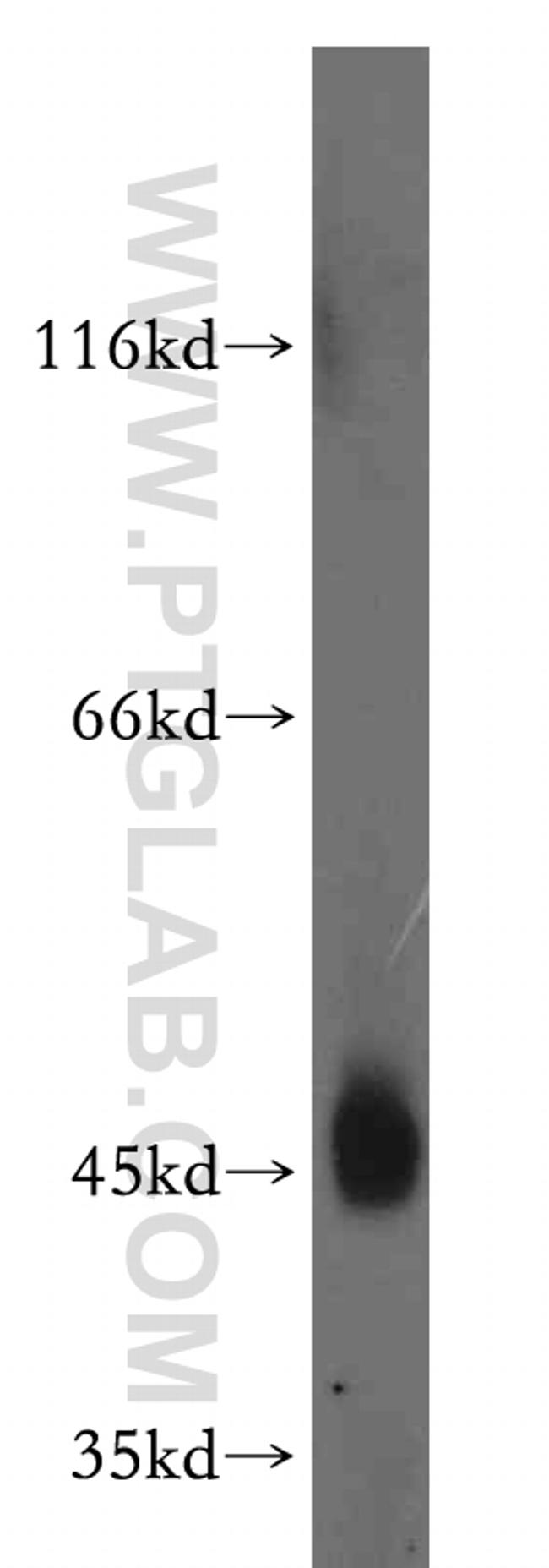 CD84 Antibody in Western Blot (WB)