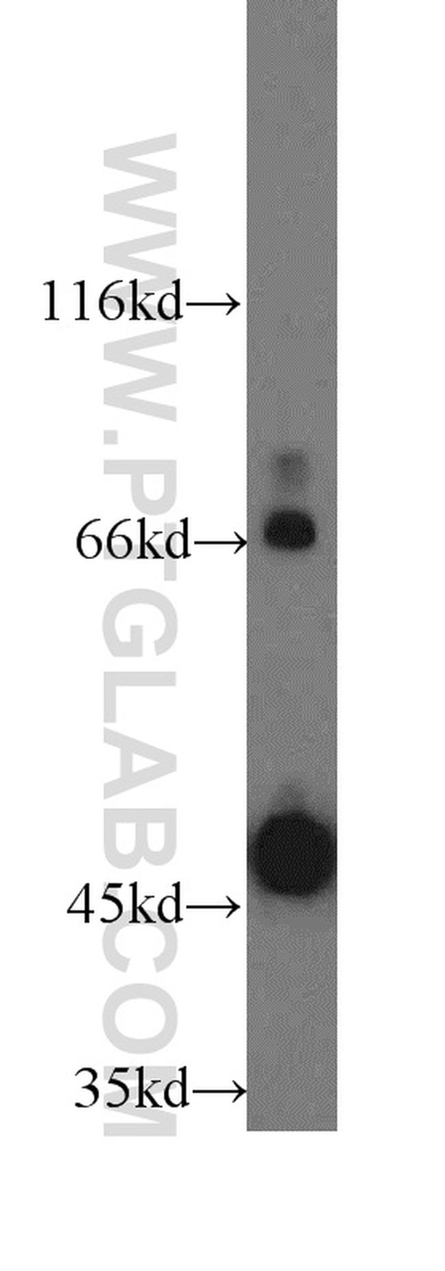 CD84 Antibody in Western Blot (WB)