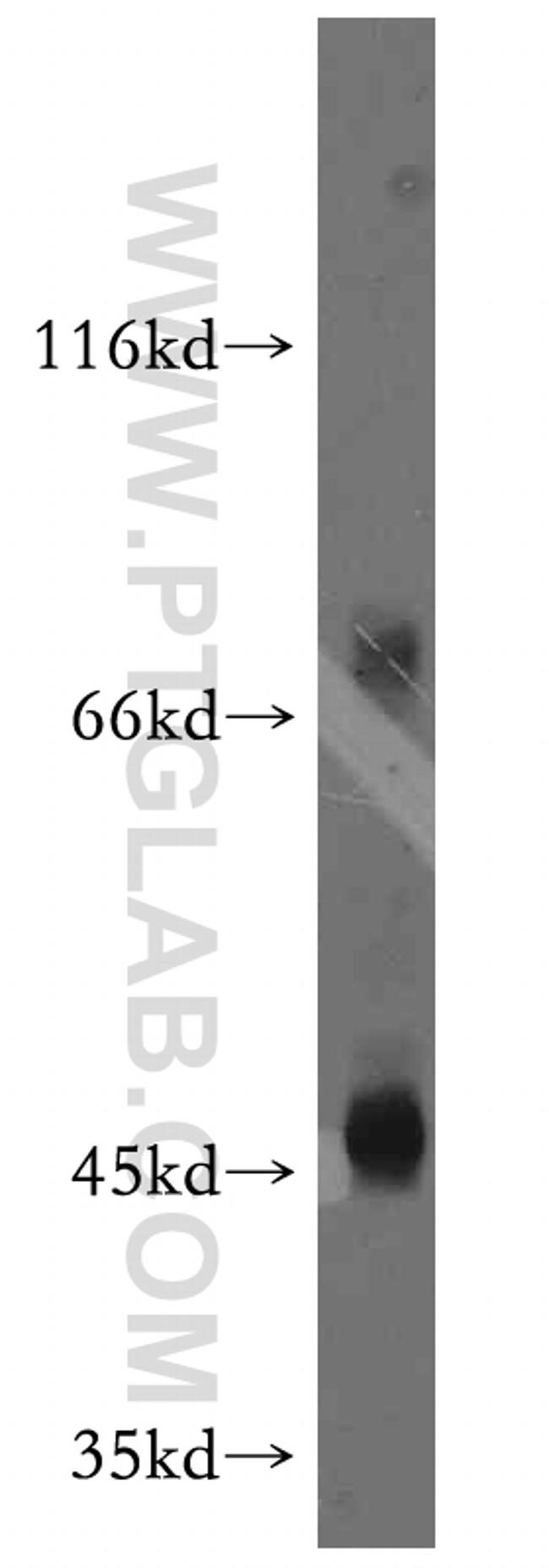 CD84 Antibody in Western Blot (WB)