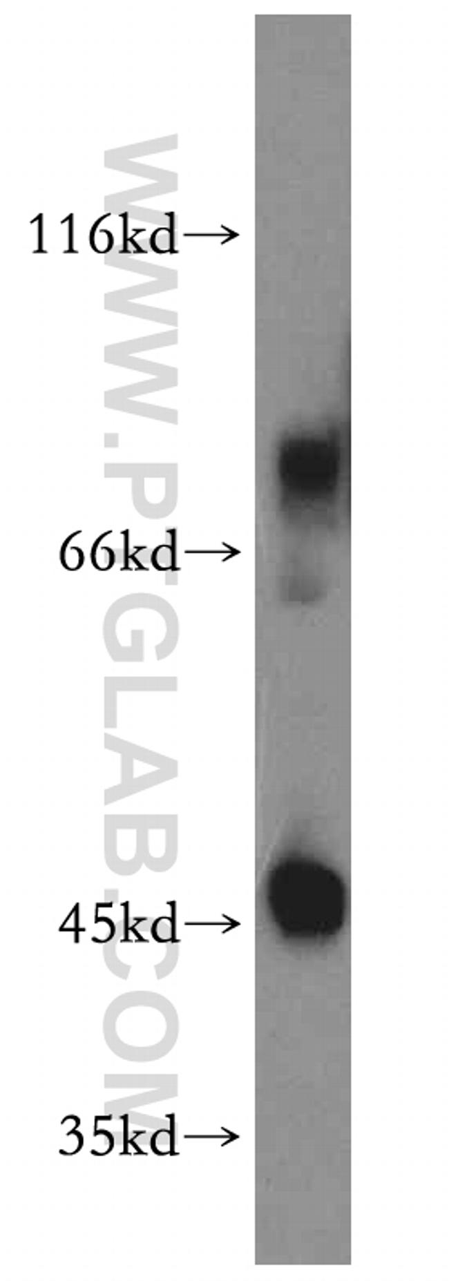 CD84 Antibody in Western Blot (WB)