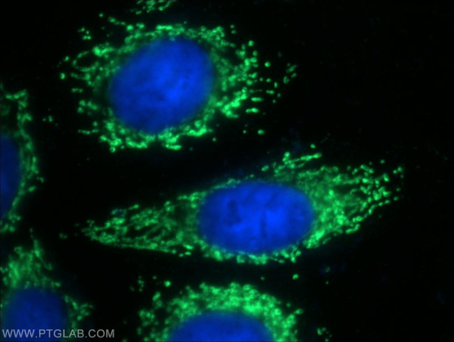 AMPK gamma2 Antibody in Immunocytochemistry (ICC/IF)