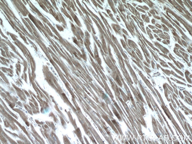 AMPK gamma2 Antibody in Immunohistochemistry (Paraffin) (IHC (P))