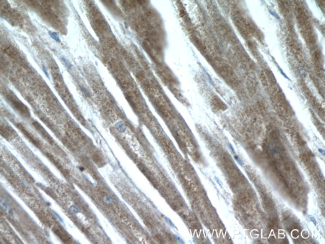 AMPK gamma2 Antibody in Immunohistochemistry (Paraffin) (IHC (P))