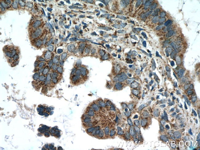 AMPK gamma2 Antibody in Immunohistochemistry (Paraffin) (IHC (P))