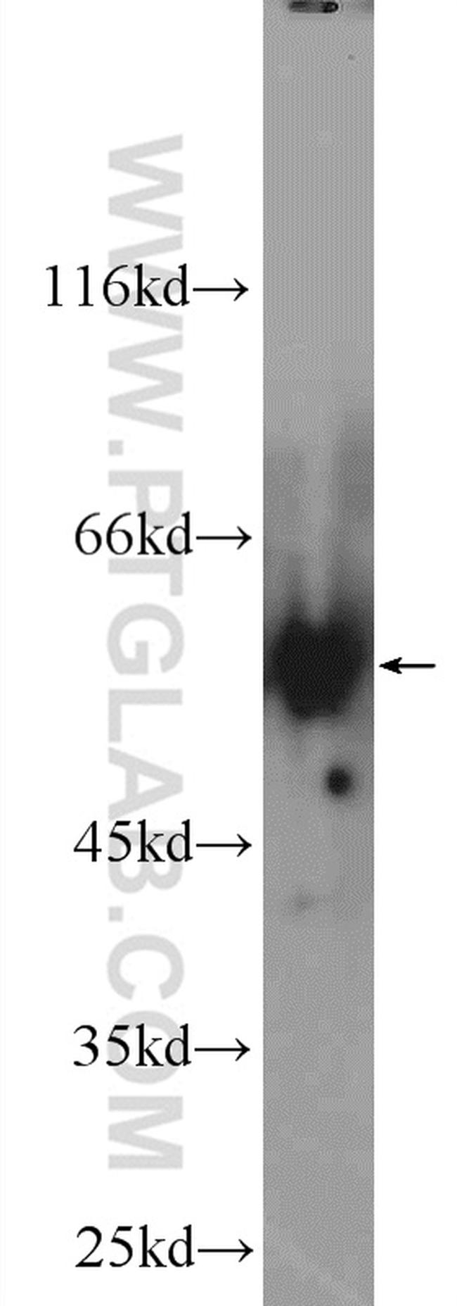 AMPK gamma2 Antibody in Western Blot (WB)