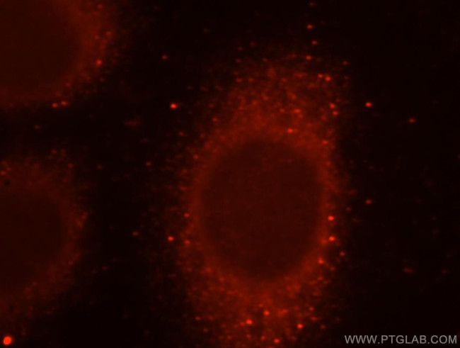 SCFD1 Antibody in Immunocytochemistry (ICC/IF)