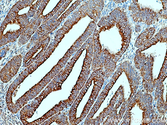 SCFD1 Antibody in Immunohistochemistry (Paraffin) (IHC (P))