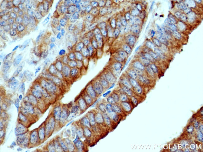 SCFD1 Antibody in Immunohistochemistry (Paraffin) (IHC (P))