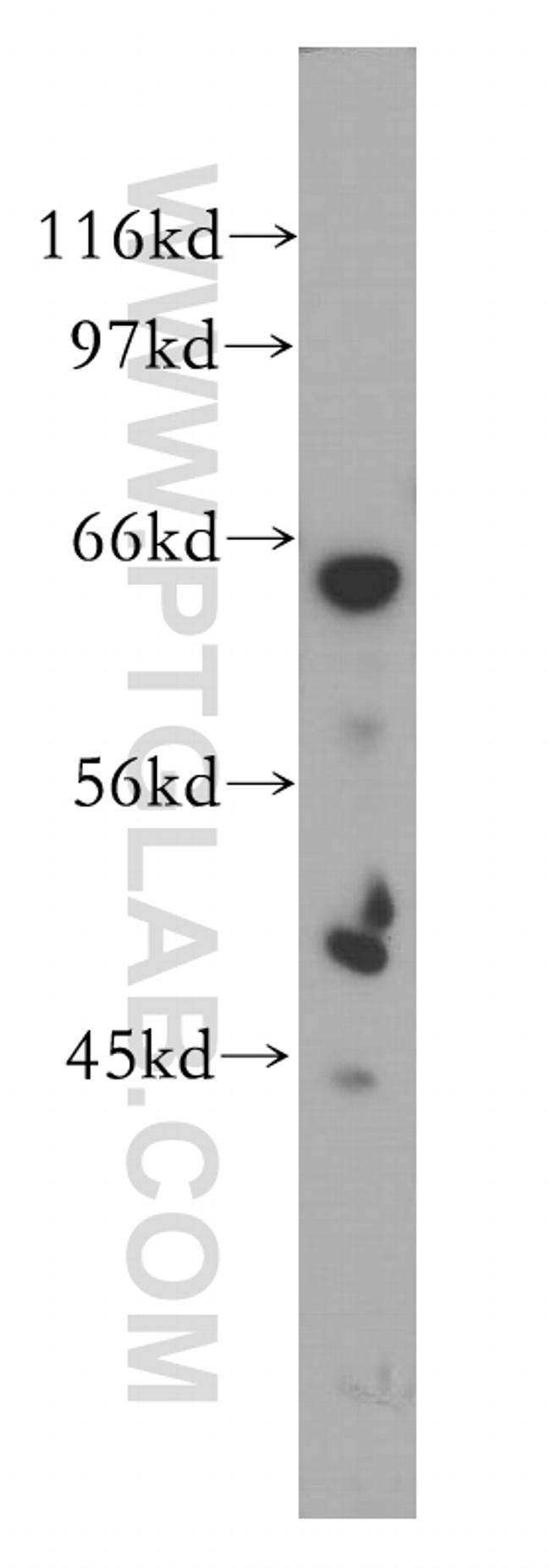 SCFD1 Antibody in Western Blot (WB)