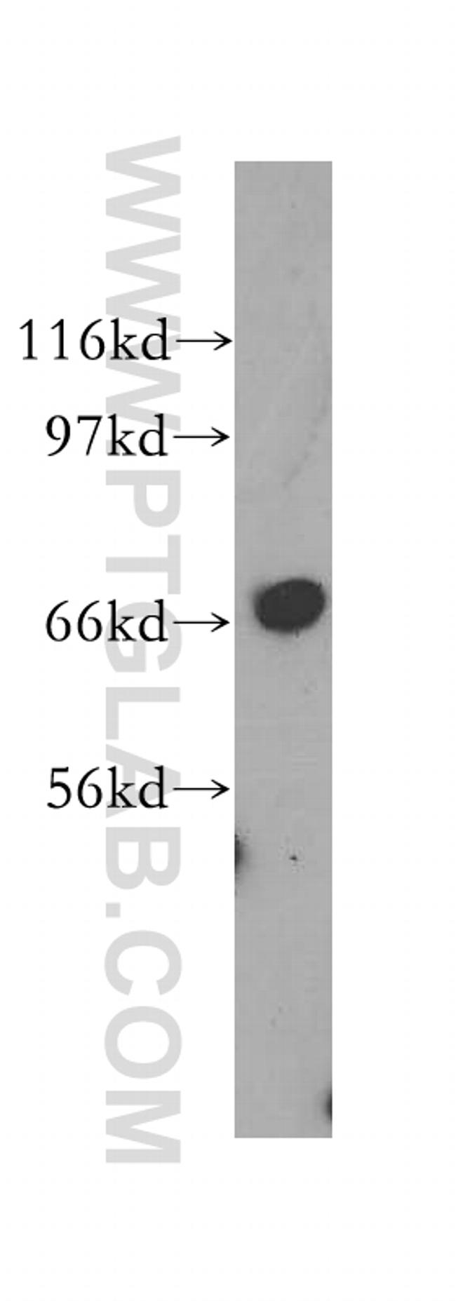 SCFD1 Antibody in Western Blot (WB)