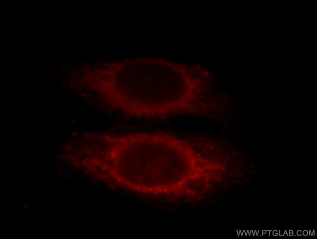 SMAD2 Antibody in Immunocytochemistry (ICC/IF)