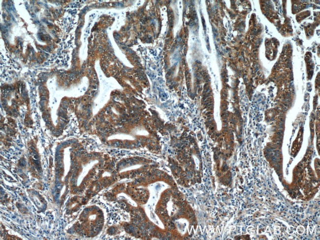 SMAD2 Antibody in Immunohistochemistry (Paraffin) (IHC (P))