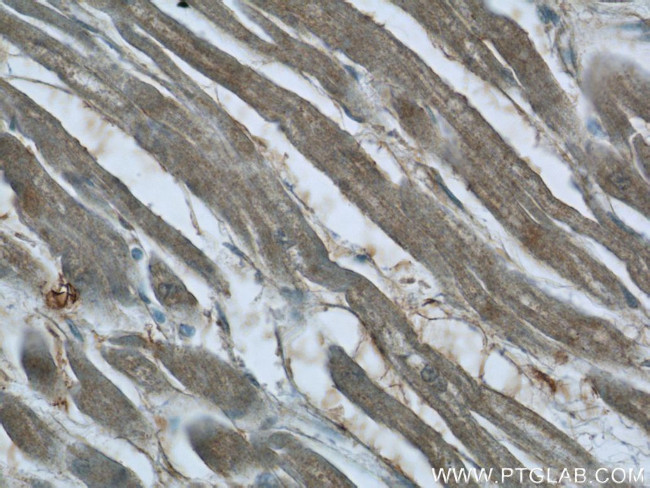 SMAD2 Antibody in Immunohistochemistry (Paraffin) (IHC (P))