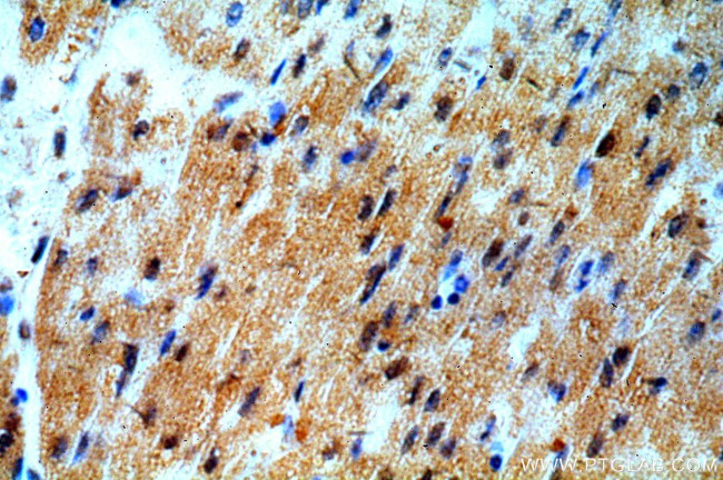 SMAD2 Antibody in Immunohistochemistry (Paraffin) (IHC (P))