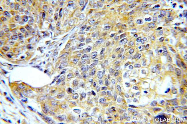 SMAD2 Antibody in Immunohistochemistry (Paraffin) (IHC (P))