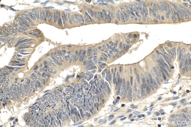 SMAD2 Antibody in Immunohistochemistry (Paraffin) (IHC (P))