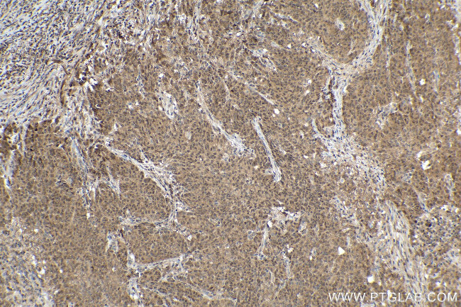 SMAD2 Antibody in Immunohistochemistry (Paraffin) (IHC (P))