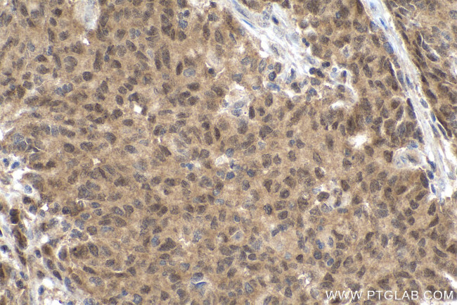 SMAD2 Antibody in Immunohistochemistry (Paraffin) (IHC (P))