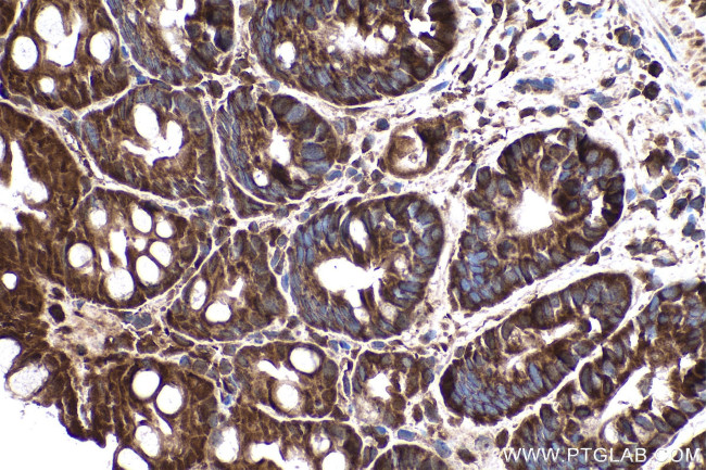 SMAD2 Antibody in Immunohistochemistry (Paraffin) (IHC (P))