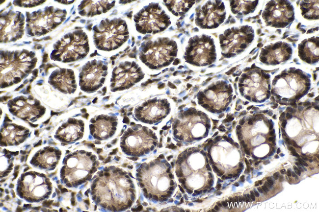 SMAD2 Antibody in Immunohistochemistry (Paraffin) (IHC (P))