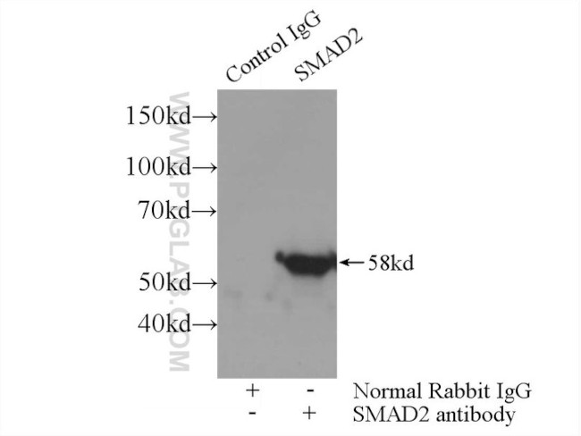 SMAD2 Antibody in Immunoprecipitation (IP)