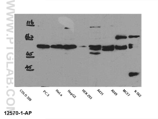 SMAD2 Antibody in Western Blot (WB)