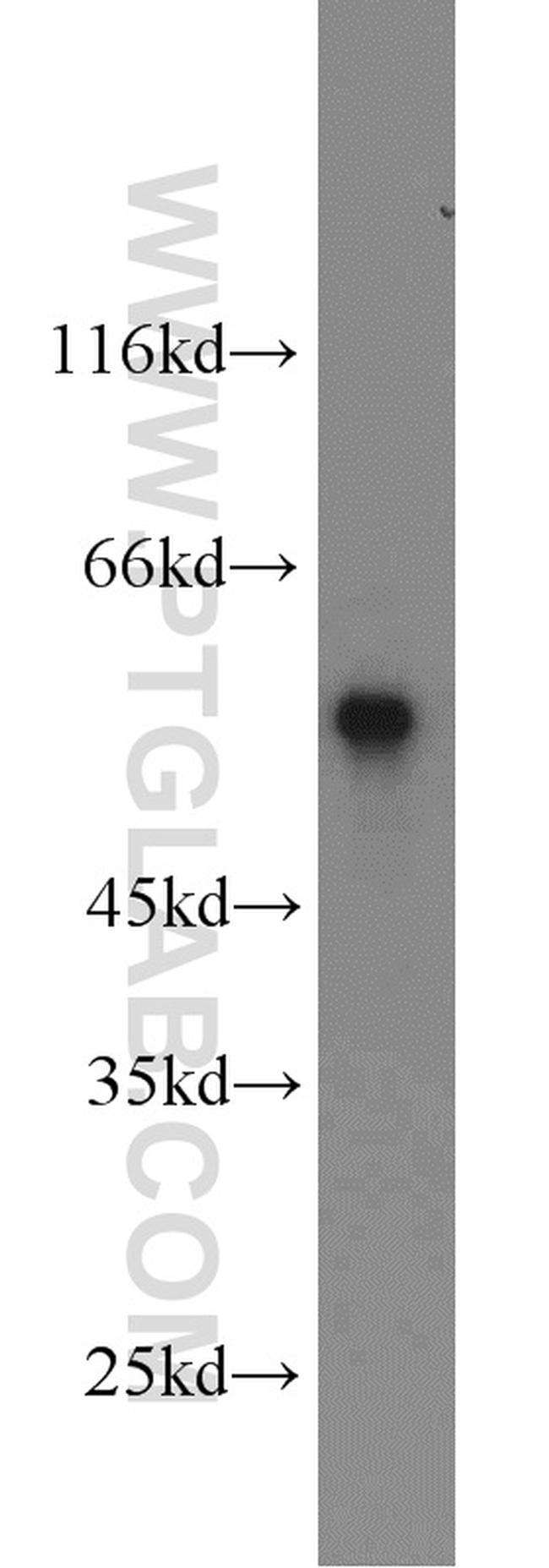 SMAD2 Antibody in Western Blot (WB)