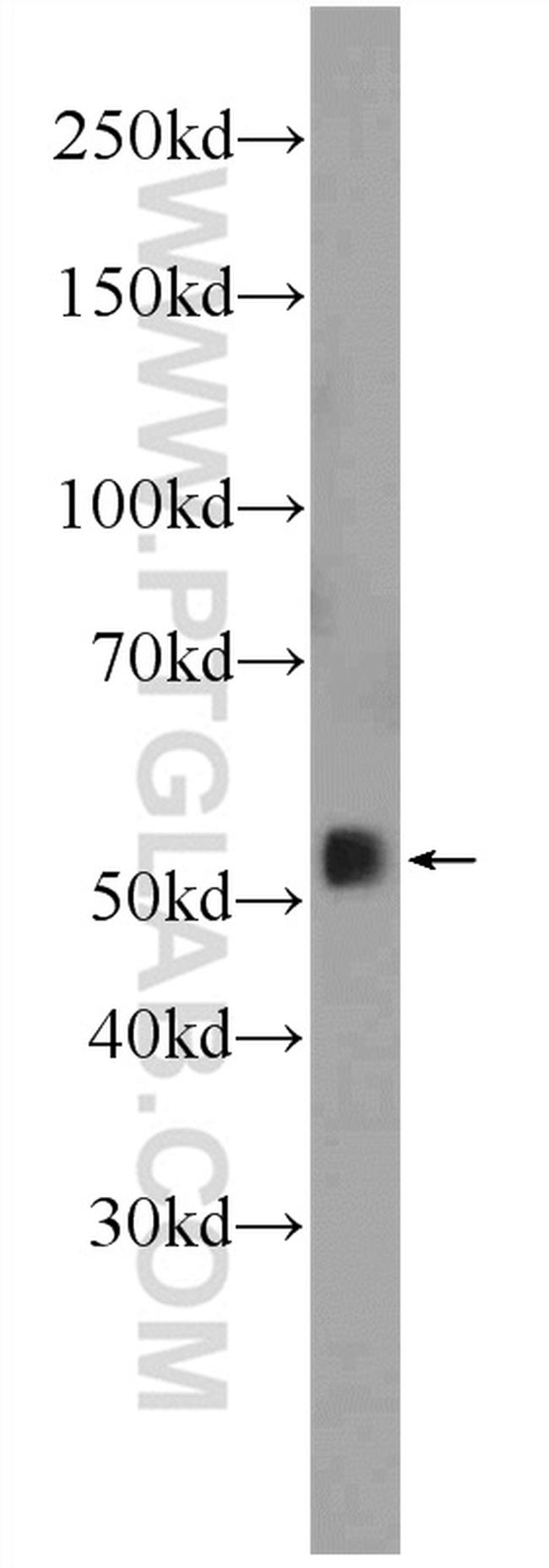 SMAD2 Antibody in Western Blot (WB)