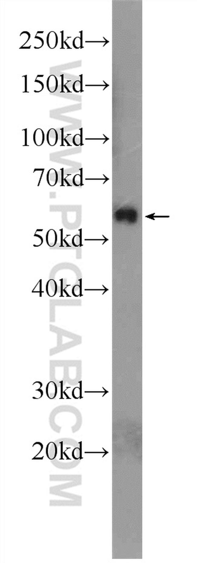 SMAD2 Antibody in Western Blot (WB)