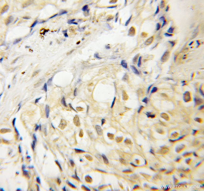 PBX3 Antibody in Immunohistochemistry (Paraffin) (IHC (P))