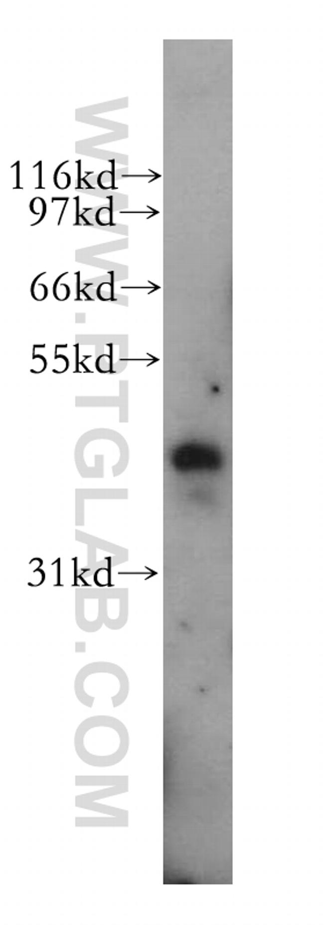 PBX3 Antibody in Western Blot (WB)