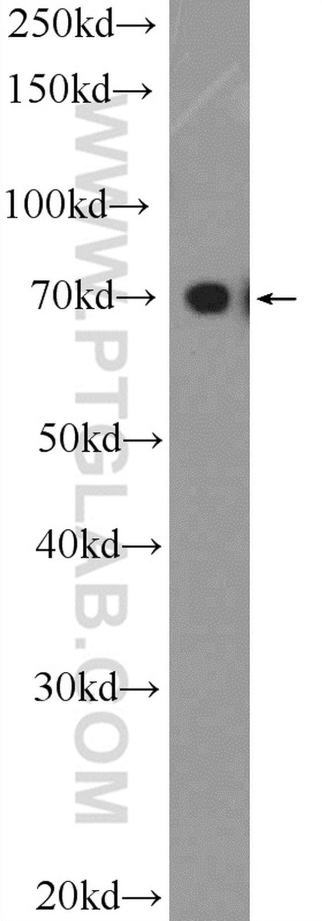 TRIM25 Antibody in Western Blot (WB)