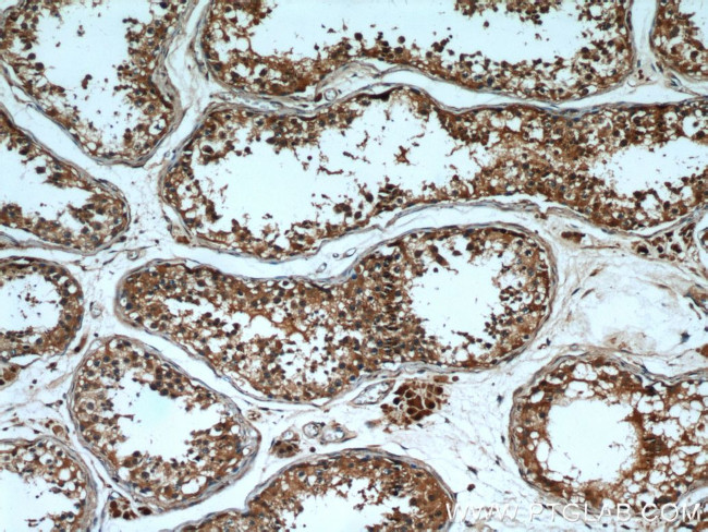 PTTG1IP Antibody in Immunohistochemistry (Paraffin) (IHC (P))