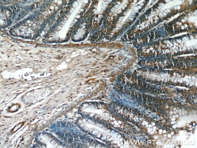 PTTG1IP Antibody in Immunohistochemistry (Paraffin) (IHC (P))