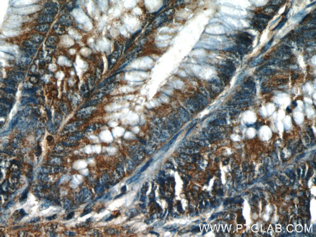 PTTG1IP Antibody in Immunohistochemistry (Paraffin) (IHC (P))