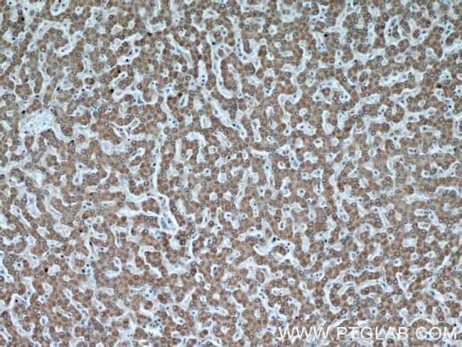 PTTG1IP Antibody in Immunohistochemistry (Paraffin) (IHC (P))