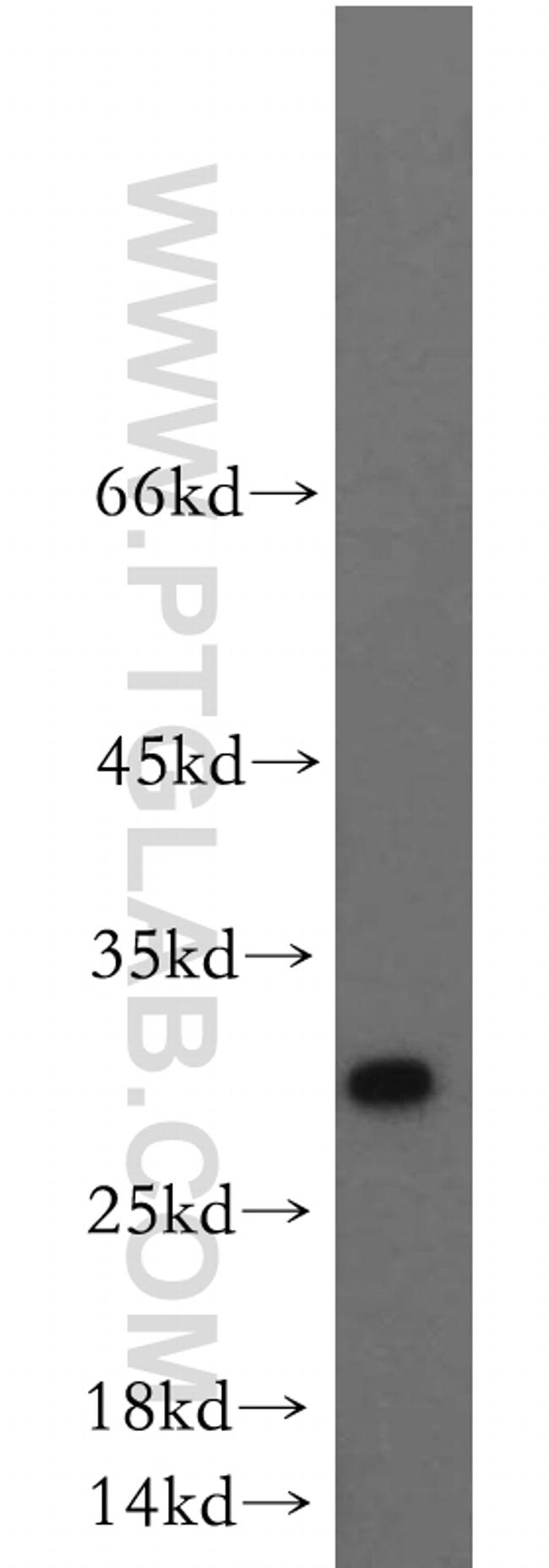 PTTG1IP Antibody in Western Blot (WB)