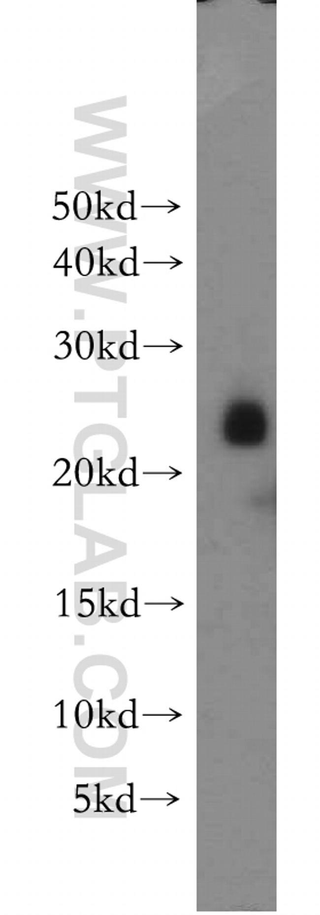 PTTG1IP Antibody in Western Blot (WB)