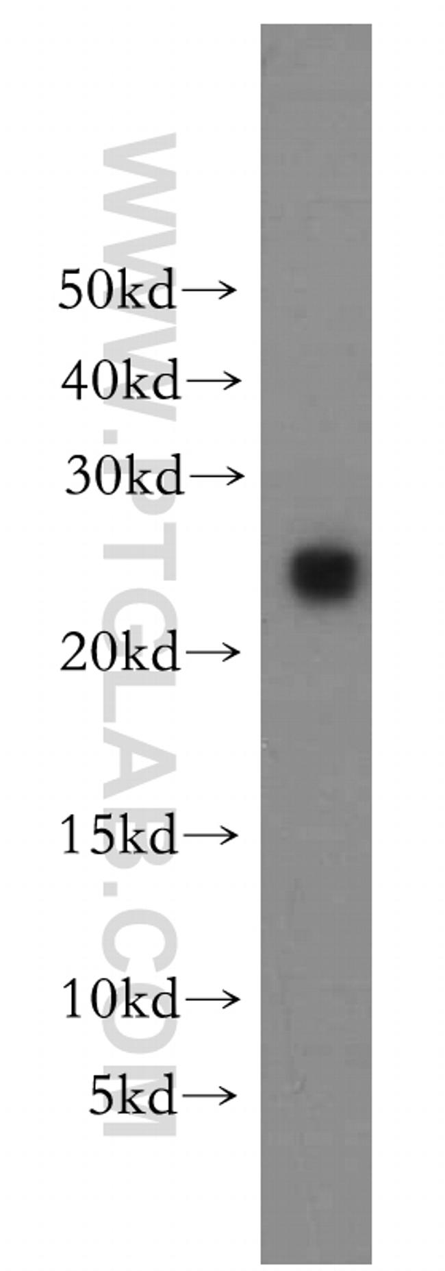 PTTG1IP Antibody in Western Blot (WB)