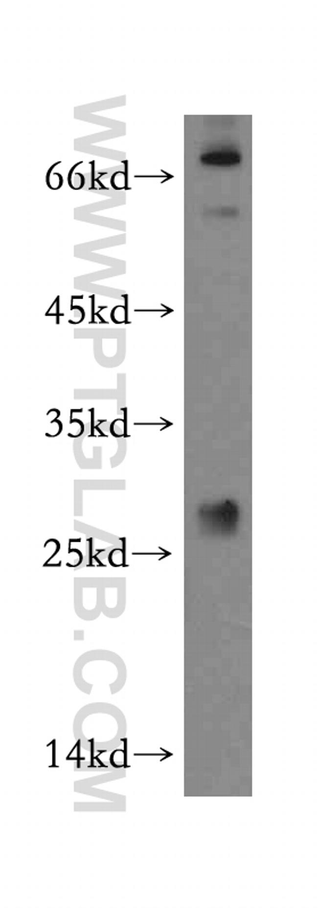 PTTG1IP Antibody in Western Blot (WB)
