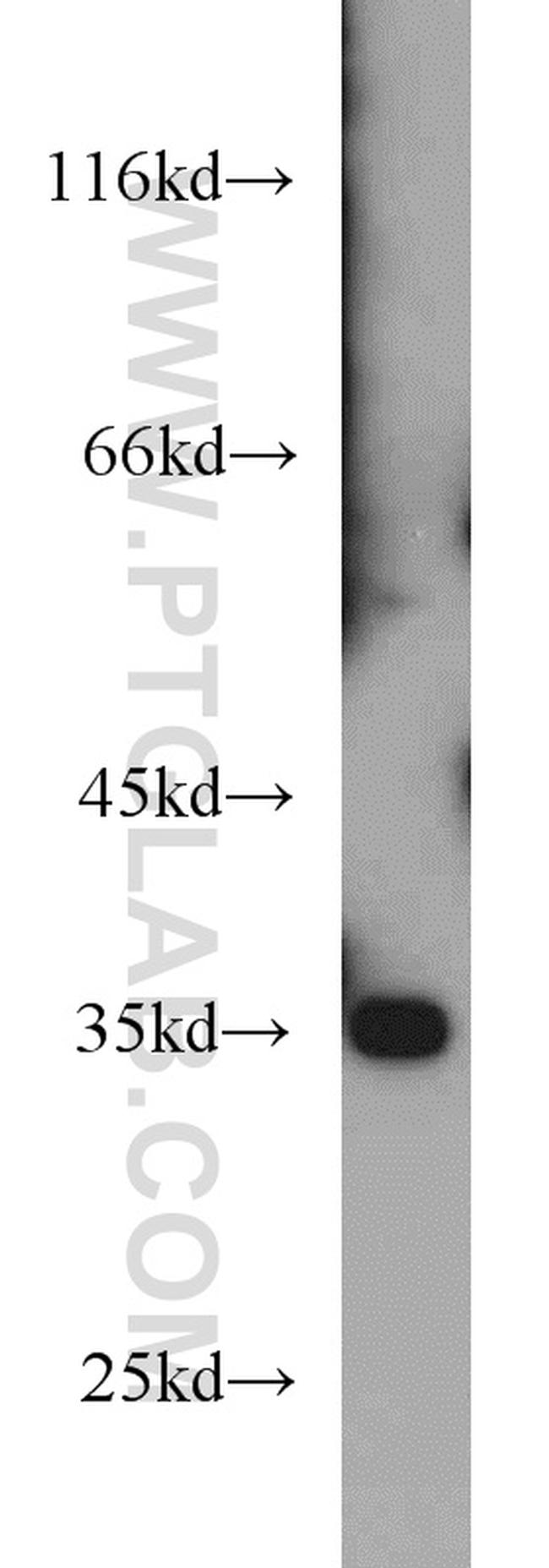 SULT4A1 Antibody in Western Blot (WB)