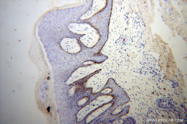 UBE2Q2 Antibody in Immunohistochemistry (Paraffin) (IHC (P))