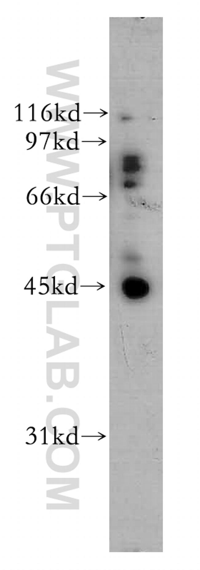 UBE2Q2 Antibody in Western Blot (WB)