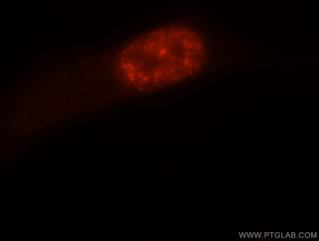 PTBP1 Antibody in Immunocytochemistry (ICC/IF)