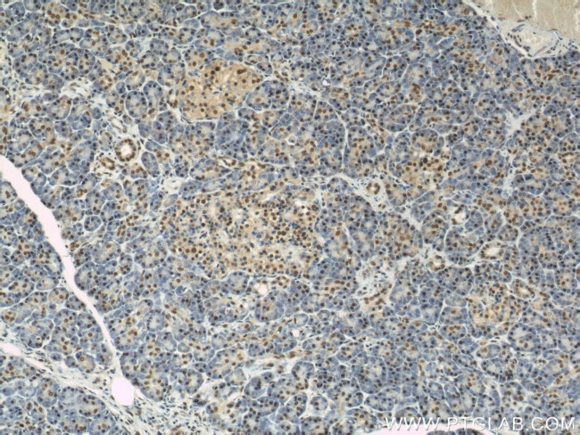 PTBP1 Antibody in Immunohistochemistry (Paraffin) (IHC (P))