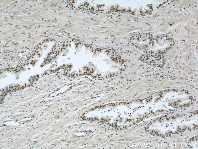 PTBP1 Antibody in Immunohistochemistry (Paraffin) (IHC (P))