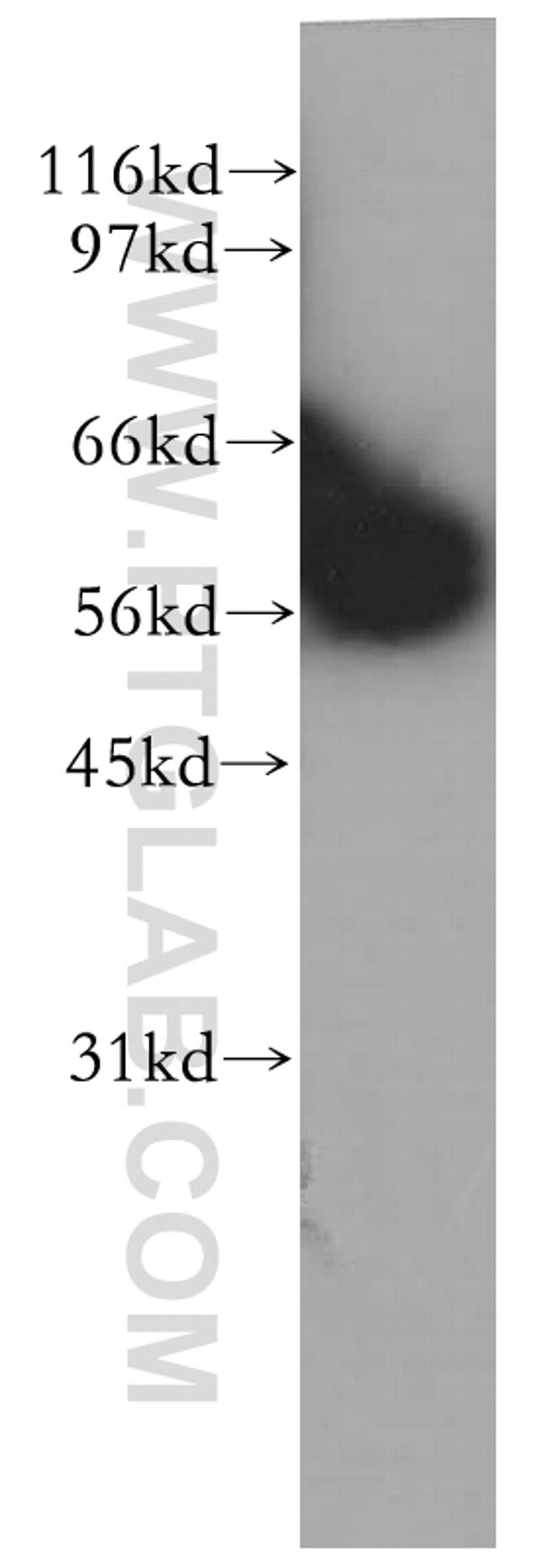 PTBP1 Antibody in Western Blot (WB)