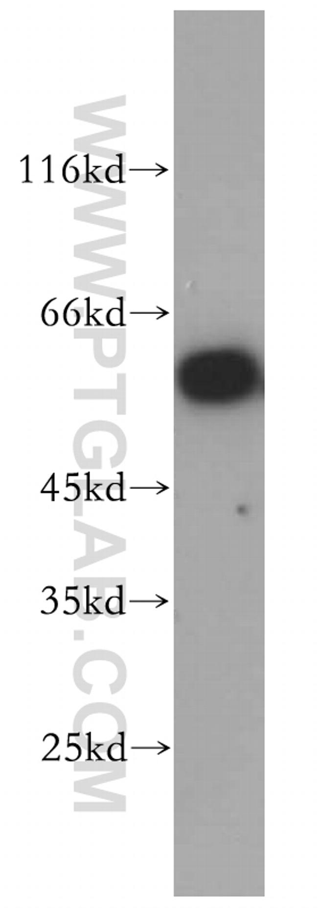 PTBP1 Antibody in Western Blot (WB)